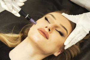HA – Microneedling HA – Microneedling