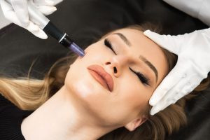 PRP - Vampire Facial