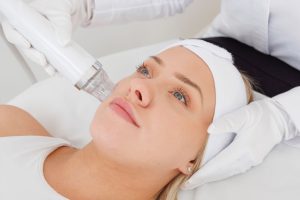 RF- Microneedling RF- Microneedling