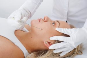 Thread Face Lift Thread Face Lift